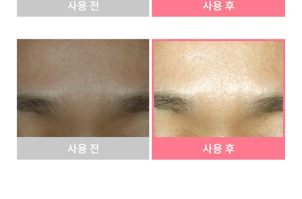 [겉쫀속촉/화잘먹] 웰더마 PDRN 엑소좀 젤리 겔 미스트 100ml 상세페이지 34